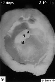 embryology9